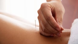 Myths about Acupuncture's Past and Benefits