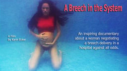 A Breech in The System - Natural Breech Child-Birth
