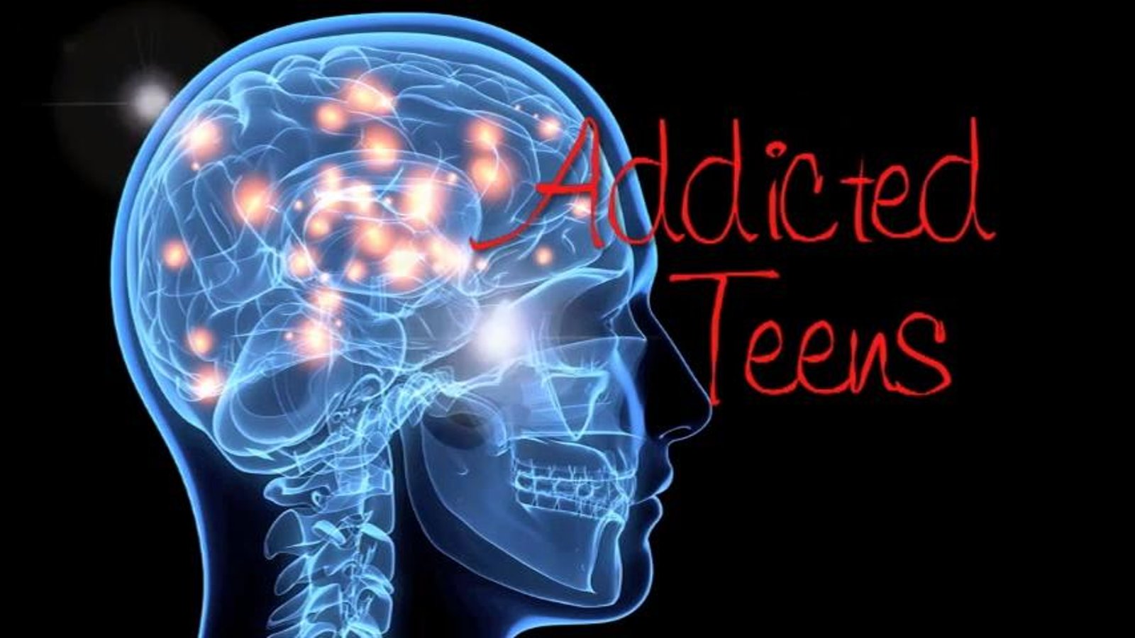 Addicted Teens - Personal Accounts of Substance Abuse Addictions