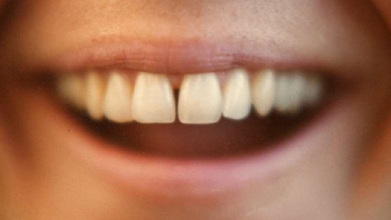 gap-toothed-women-kanopy